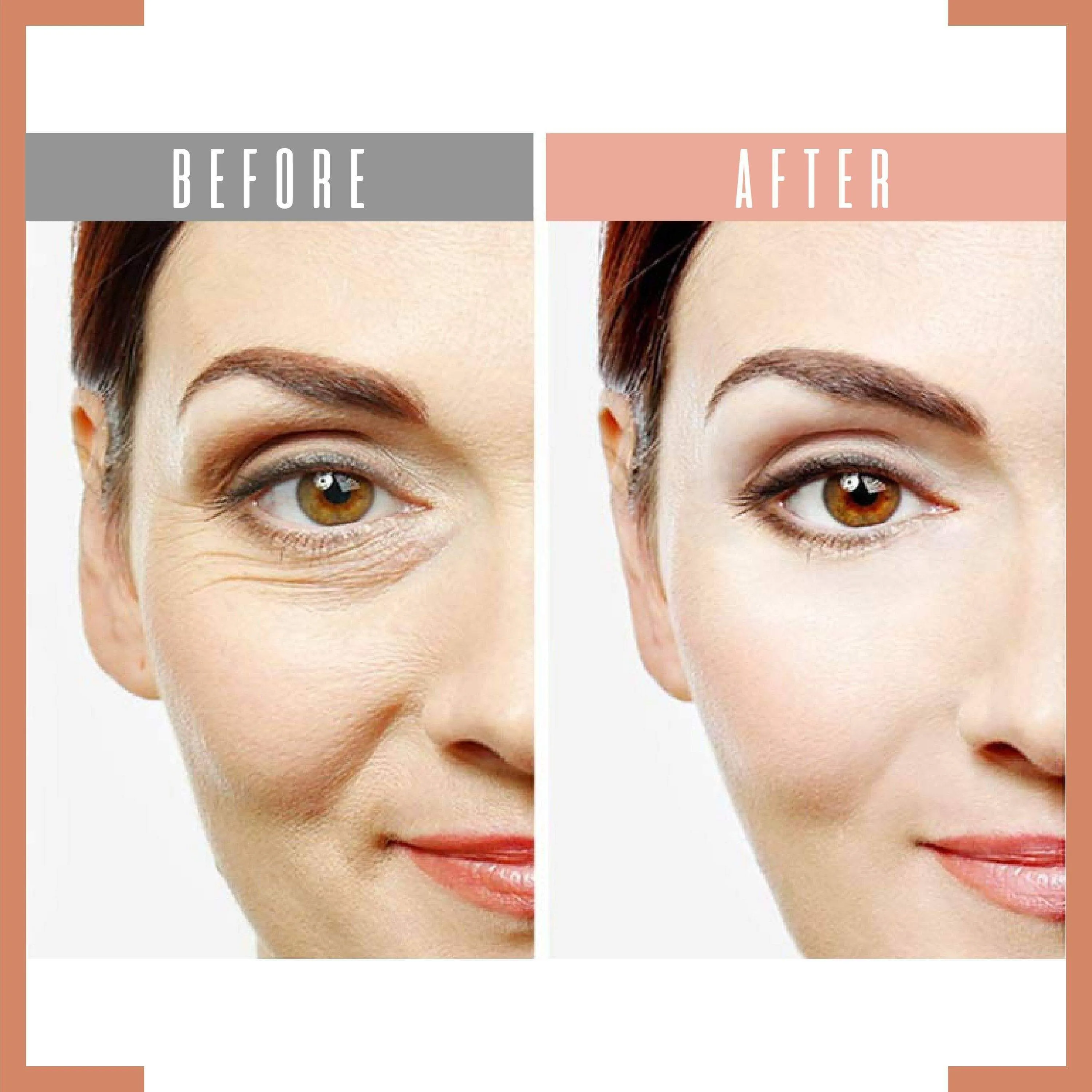 Eye Delight Boost Serum
