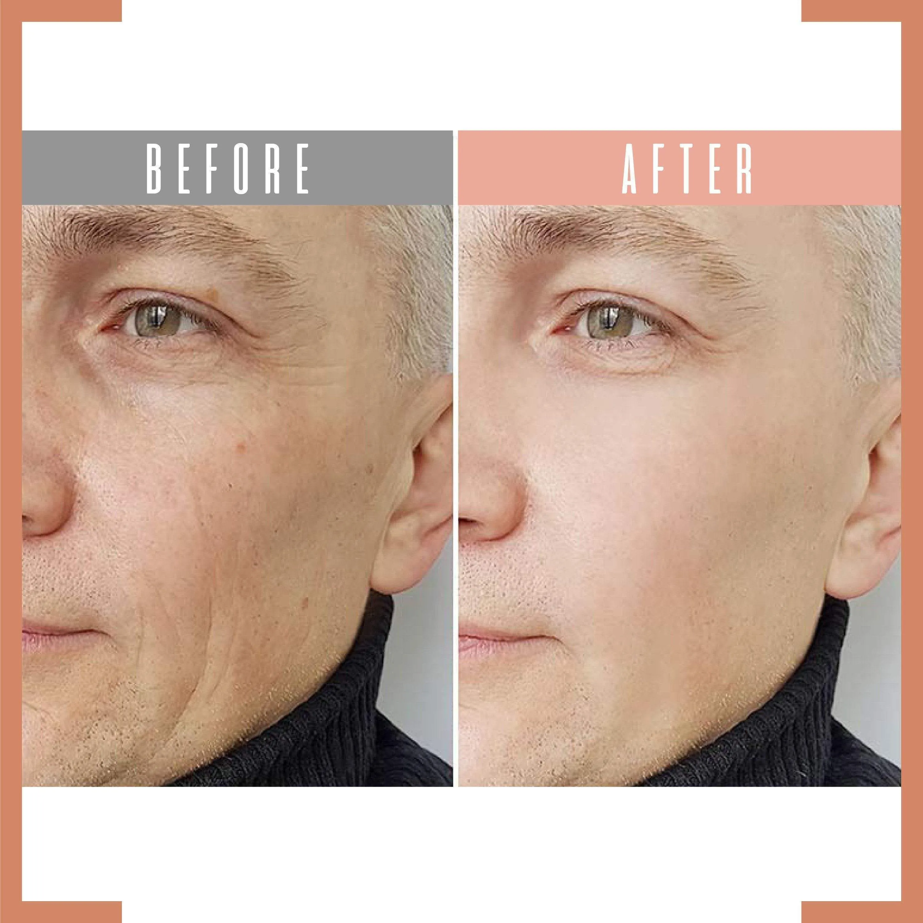 Eye Delight Boost Serum